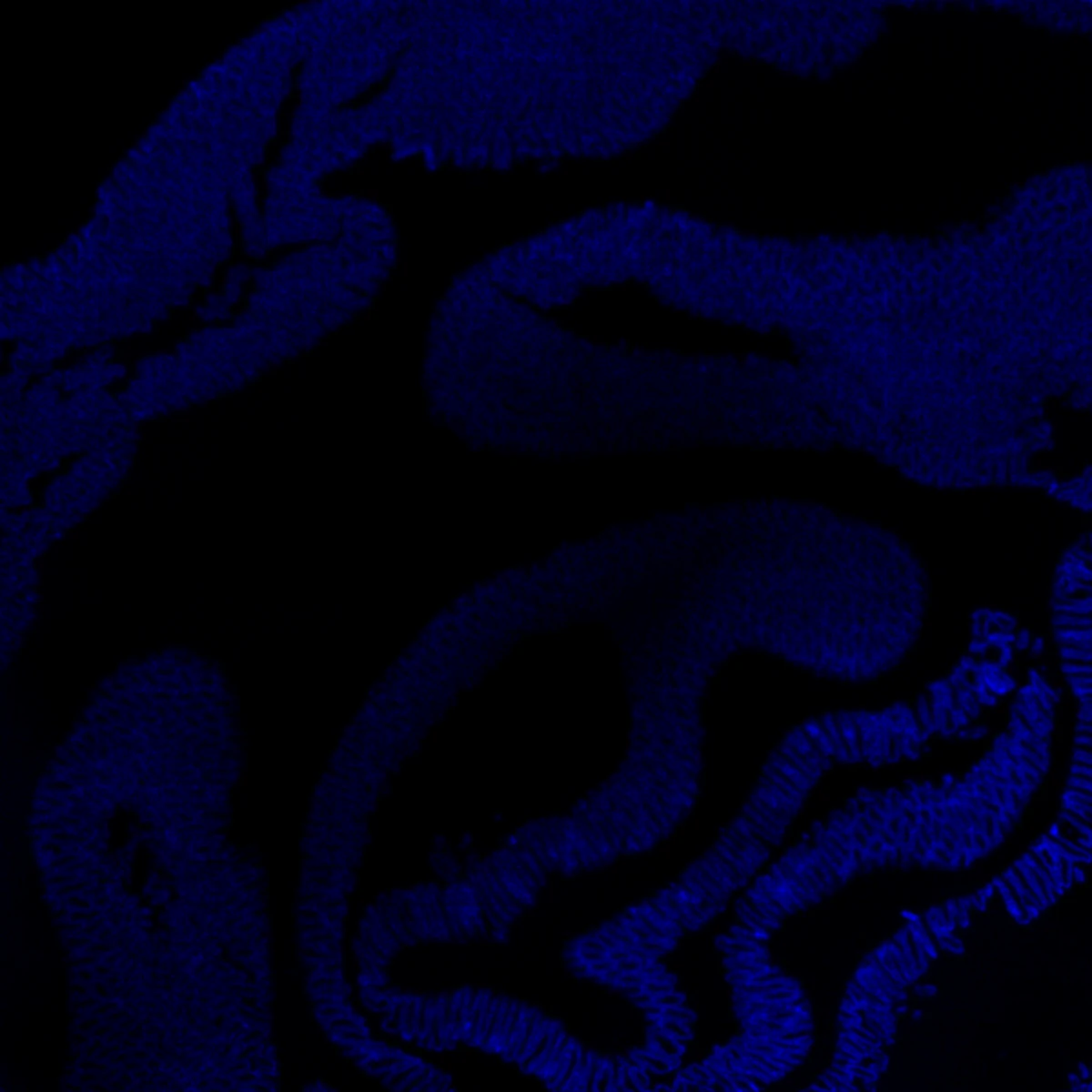 APOA1 expression in the same intestine tissue section