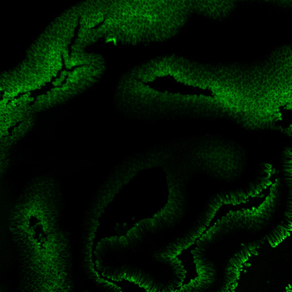 APOA4 expression in the same intestine tissue section