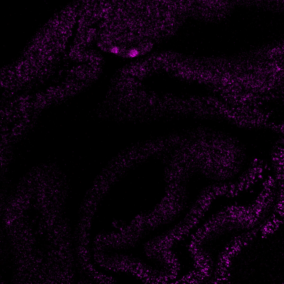 Immune marker signal in the same intestine tissue section